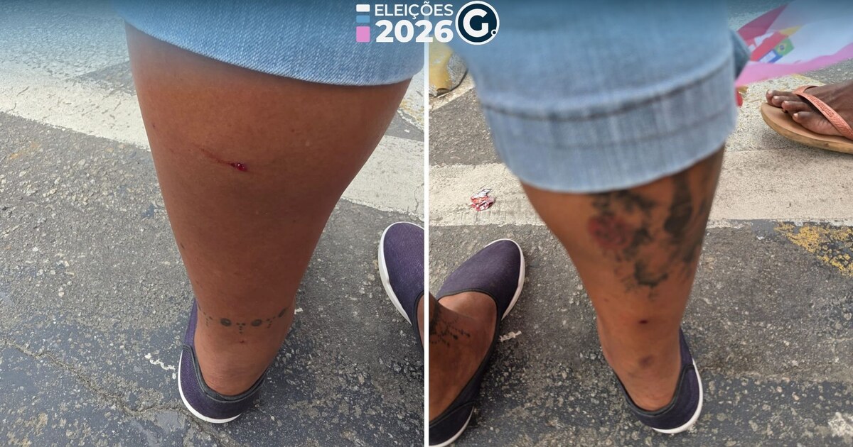 Campanha de Jack Rocha relata ataque com artefato em Cachoeiro; Sesp registra lesões leves