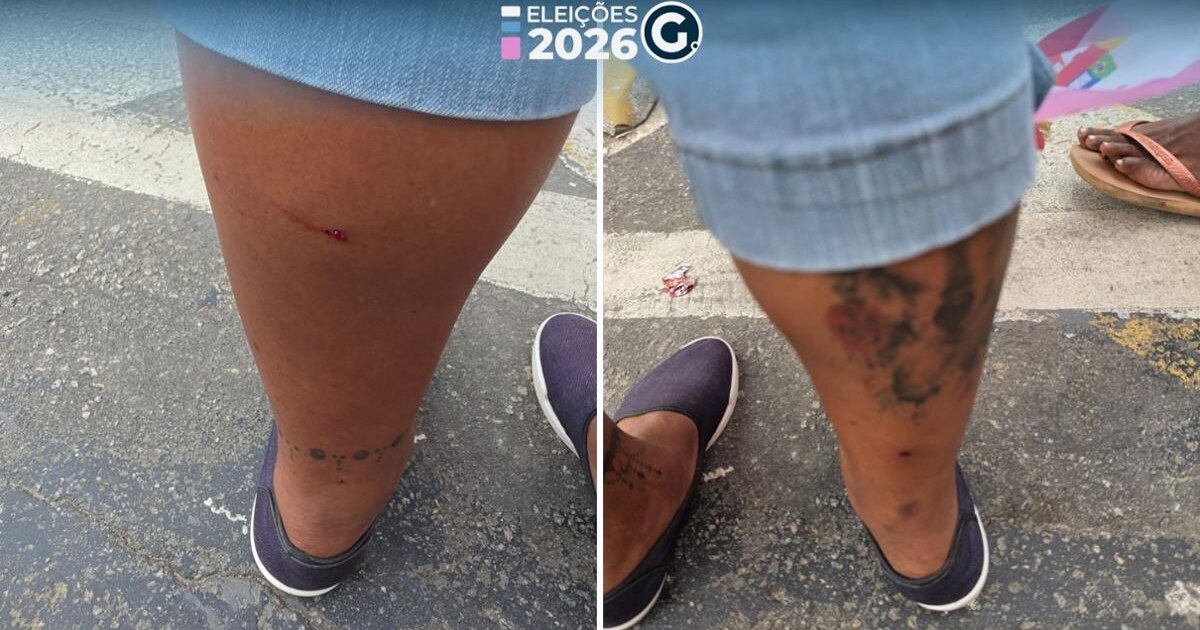 Equipe de Jack Rocha é atingida por artefato em Cachoeiro; Sesp orienta denúncia à Corregedoria